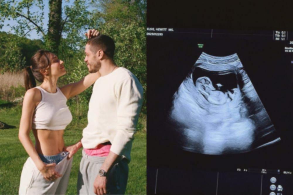 Pete Davidson & Elsie Hewitt Umumkan Kehamilan Setelah 4 Bulan Pacaran!